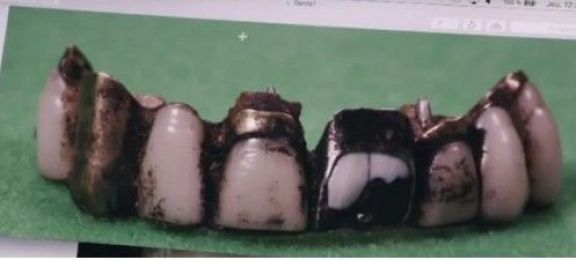 ¡Fin del misterio! Confirman que Hitler no huyó hacia la Argentina