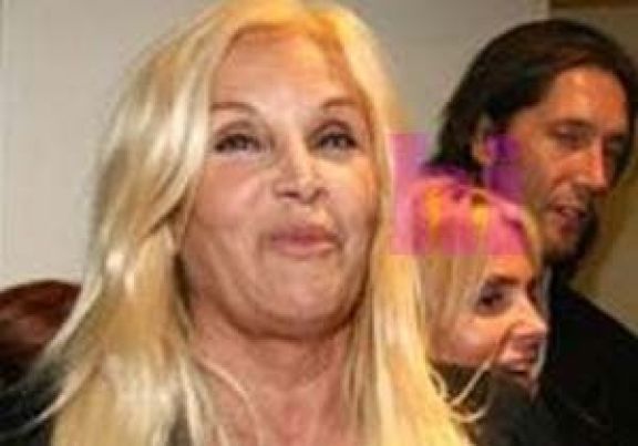 La cara real(sin photoshop) de Susana Gimenez